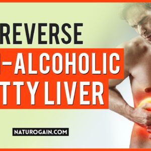 Reverse Non-Alcoholic Fatty Liver Disease Symptoms Natural Treatment 😌🌿