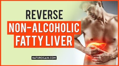 Reverse Non-Alcoholic Fatty Liver Disease Symptoms Natural Treatment 😌🌿