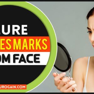 Cure Pimples Acne Marks Removal On Face At Home Get Clearskin Naturally💊👌😲