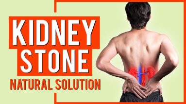 Kidney Stones Natural Solution Without Surgery Nephrolithiasis Signs⚡🥵🤷‍♂️