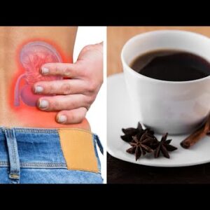 Star Anise Coffee: A Natural And Effective Treatment For Kidney Stones