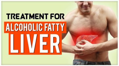 Treatment For Alcoholic Fatty Liver Disease Symptoms |Improve Function