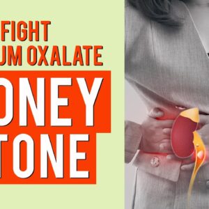 Natural Remedies to Fight Calcium Oxalate Kidney Stones Symptoms at Home