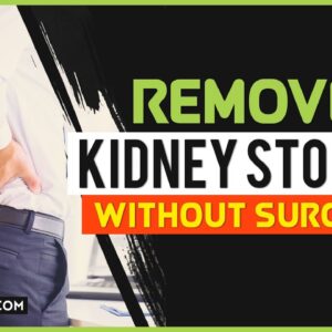 How to Remove Kidney Stones Naturally Without Surgery?💊👌😲