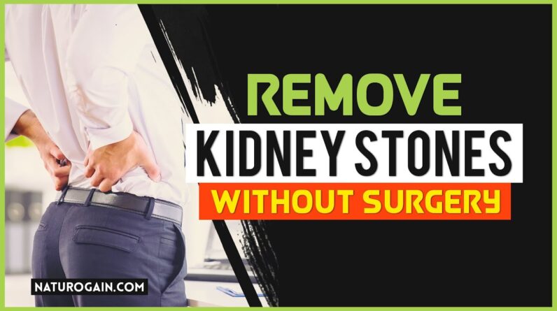 How to Remove Kidney Stones Naturally Without Surgery?💊👌😲