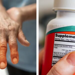 Numbness in Your Hands? This Vitamin Deficiency Could Be the Cause!