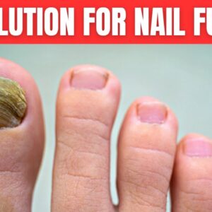 You Need Only 2 Ingredients To Get Rid of Nail Fungus Completely